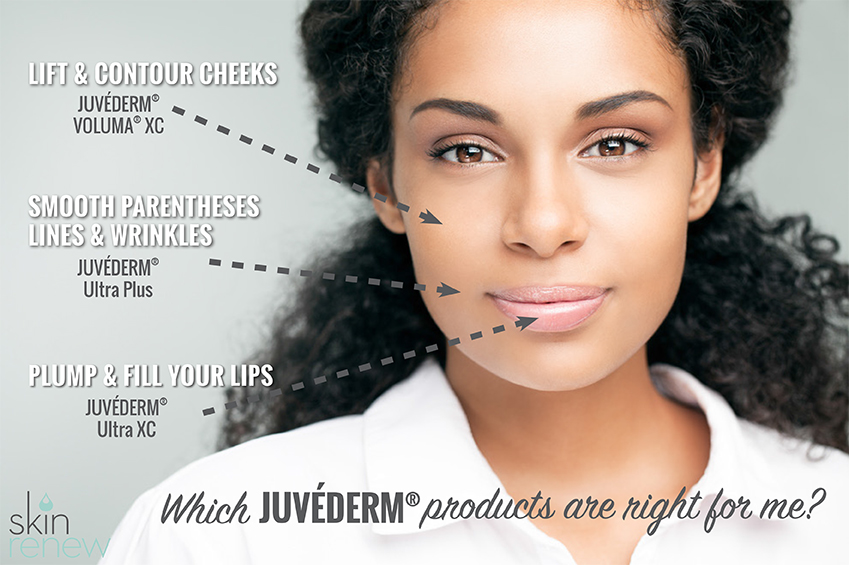 what_juvederm_product_needed